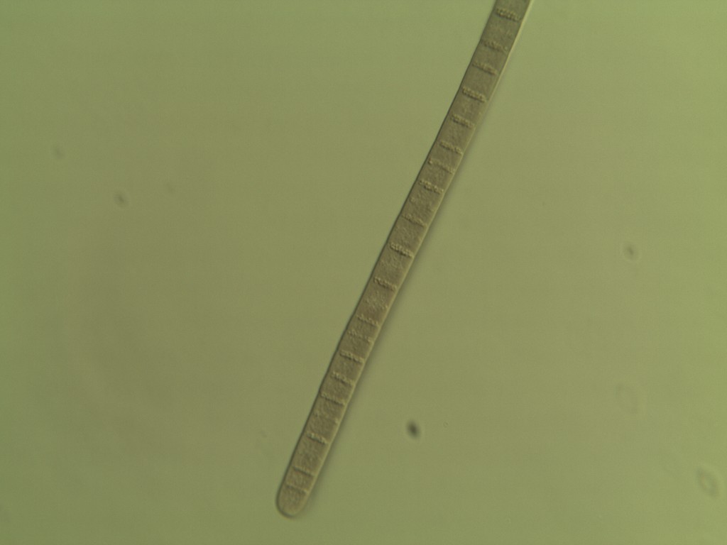 Cianoficea